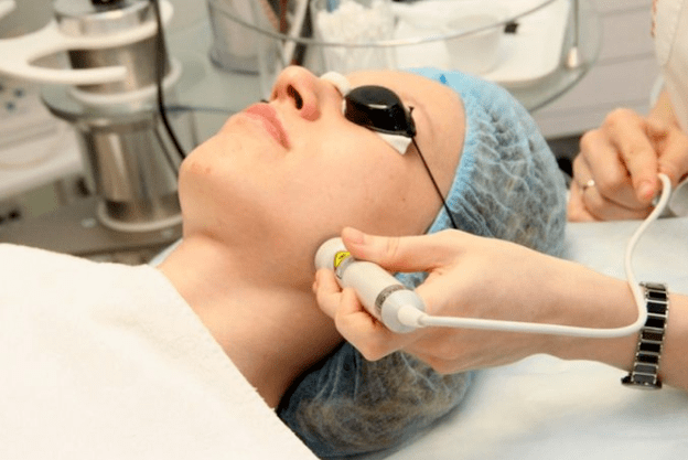 Biorévitalisation du laser